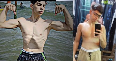 Champion Transformation