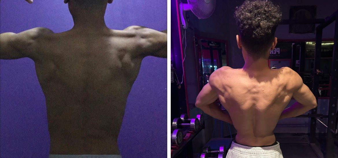 Champion Transformation